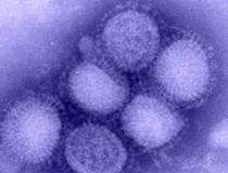 Вирус гриппа H1N1 под электронным микроскопом, фото с сайта cdc.gov